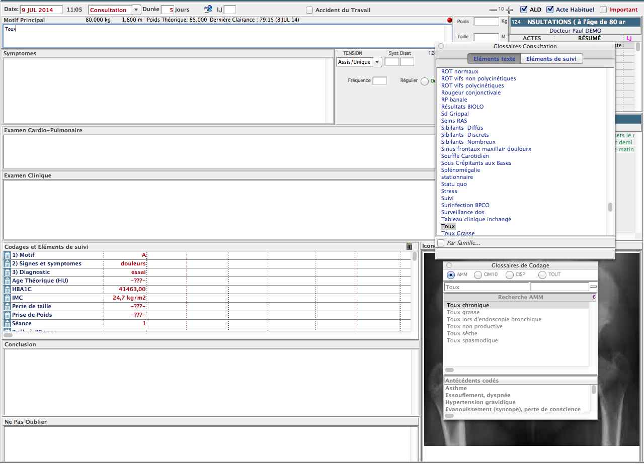Les palettes de consultation et de codage